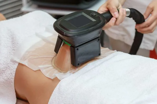 Image of person having fat freezing treatment to help weight gain Southsea