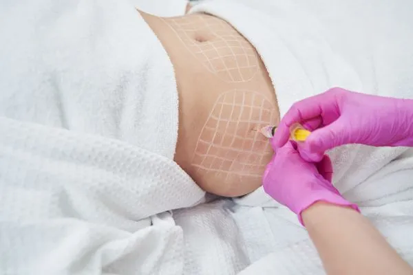 image of fat dissolving injections on love handles to help combat weight gain Southsea