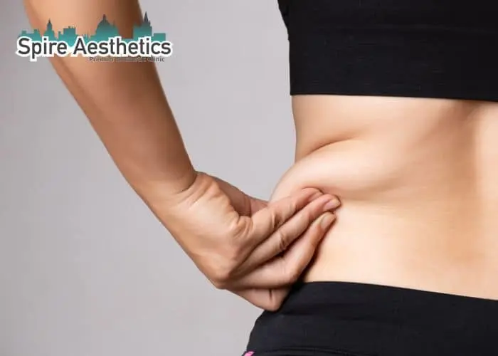 Image of woman pinching fat on their hips Southsea. Fat Freezing treatment
