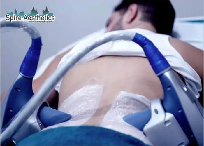 Man having fat freezing treatment done on love handles before a competitions Southsea to create a sculpted look.