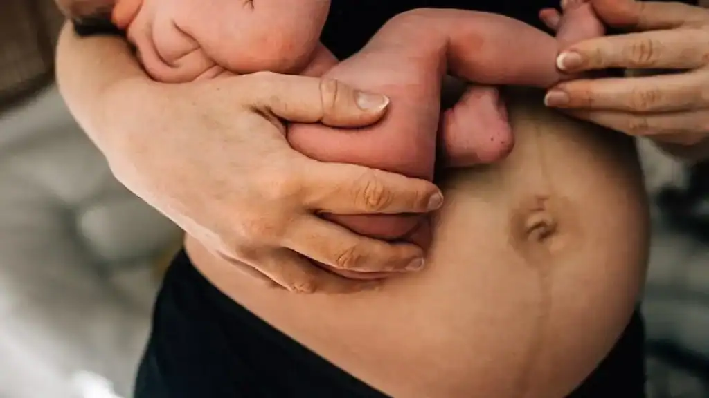 Why Is My Stomach Still Big After Pregnancy Southsea?